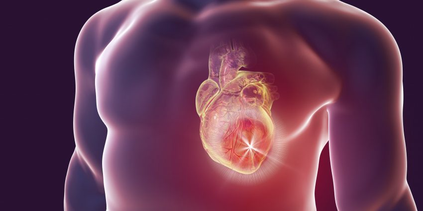 Everything you should know about heart valve disease