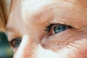 Cataracts: Symptoms, Causes & Prevention