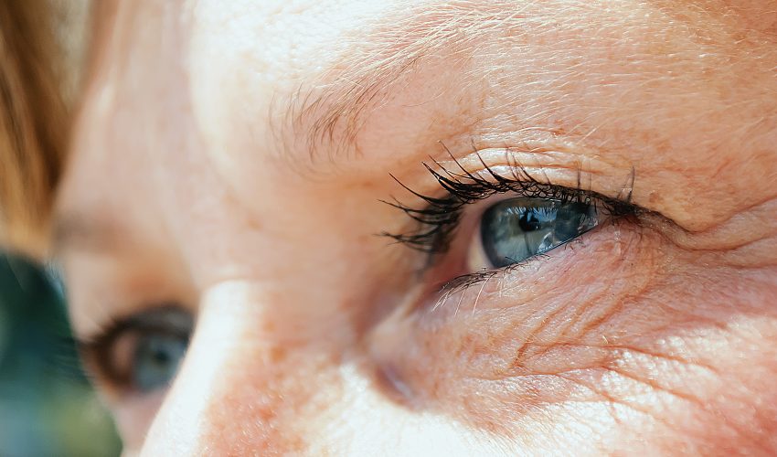 Cataracts: Symptoms, Causes & Prevention